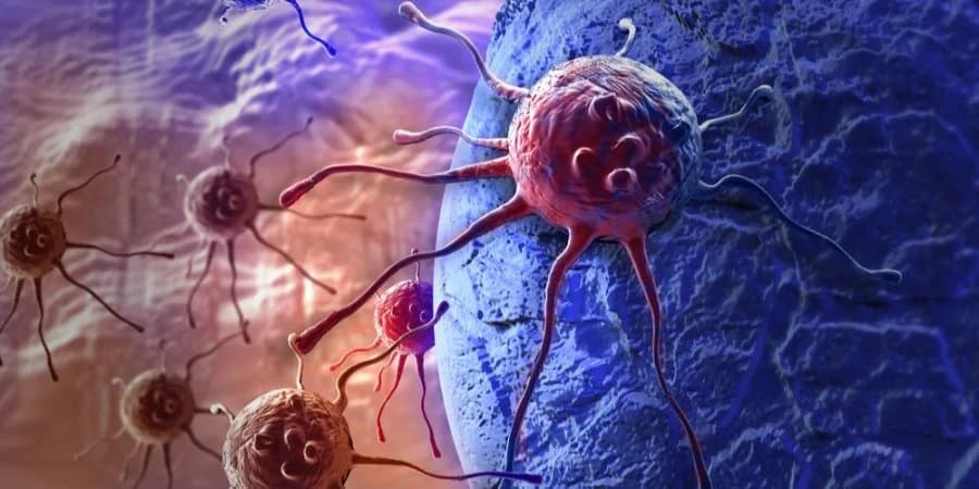 Повна ремісія: Вчені досягли неймовірного успіху в дослідженні з лікування раку прямої кишки